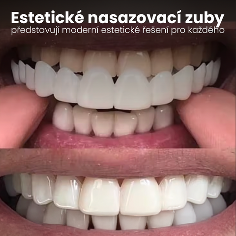 Estetické nasazovací zuby – okamžitá úprava úsměvu bez zákroku